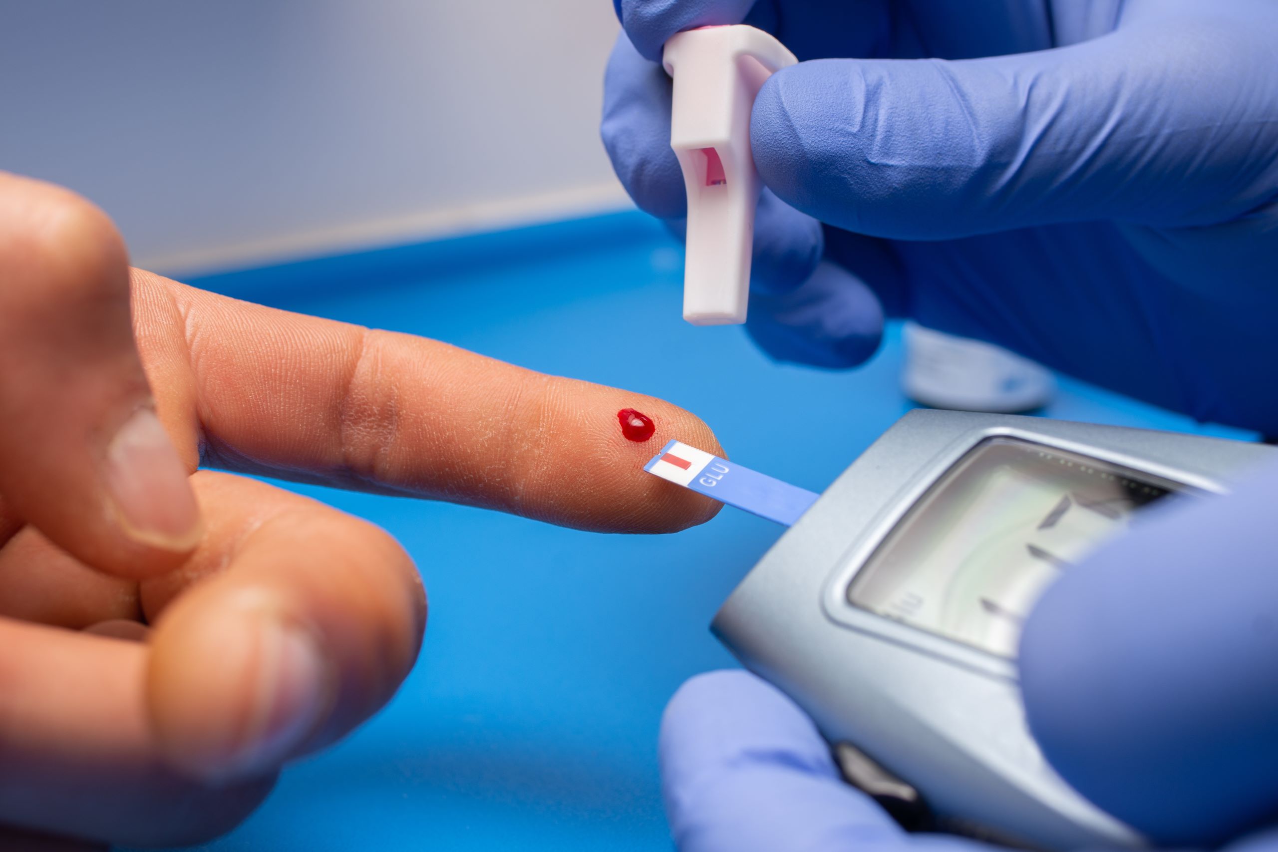 Diabetes is a chronic illness marked by elevated blood glucose (sugar) levels